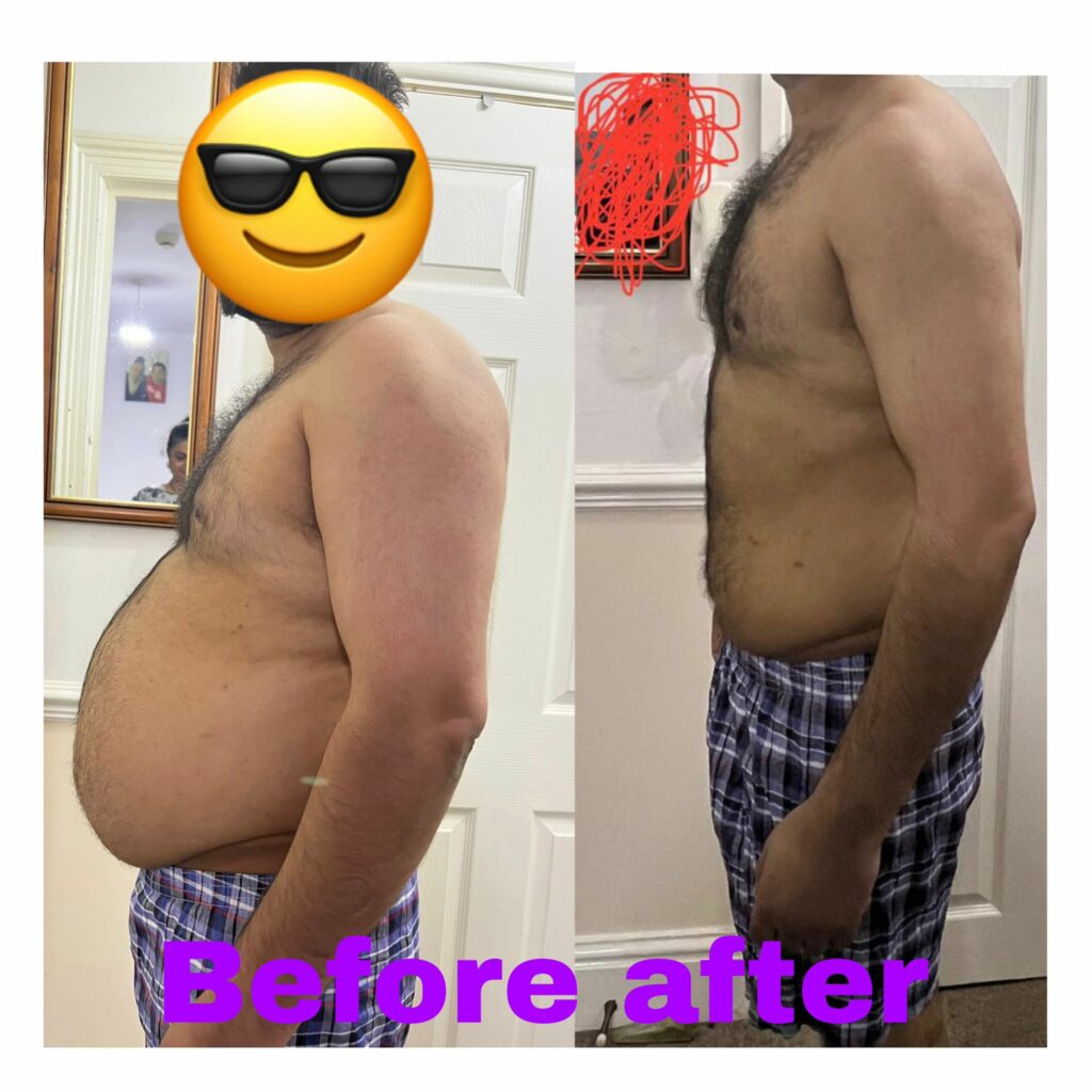 before-after transformation-6